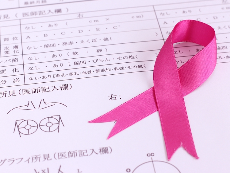 乳がん検診の受診率47％→29％の大幅減 「コロナ禍でも検診受けて」 #ピンクリボン月間